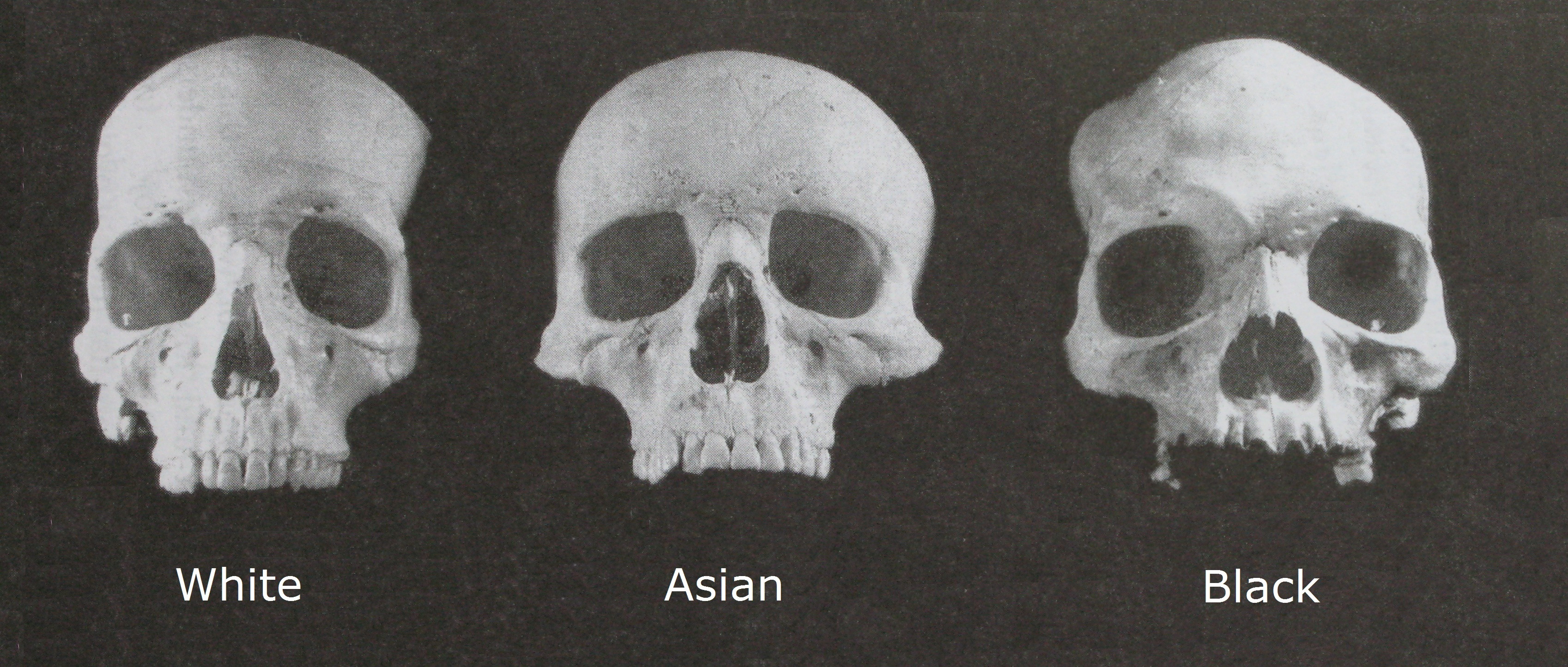 Human Differentiation: Evolution of Racial Characteristics
